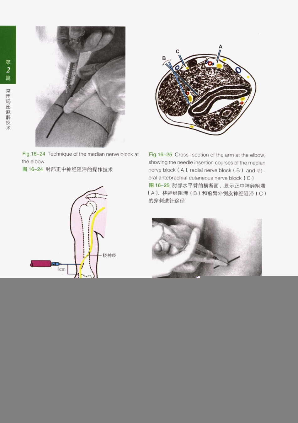 临床局部麻醉技术_226-250.pdf_第2页
