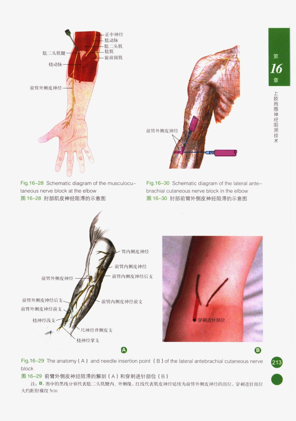 临床局部麻醉技术_226-250.pdf_第3页