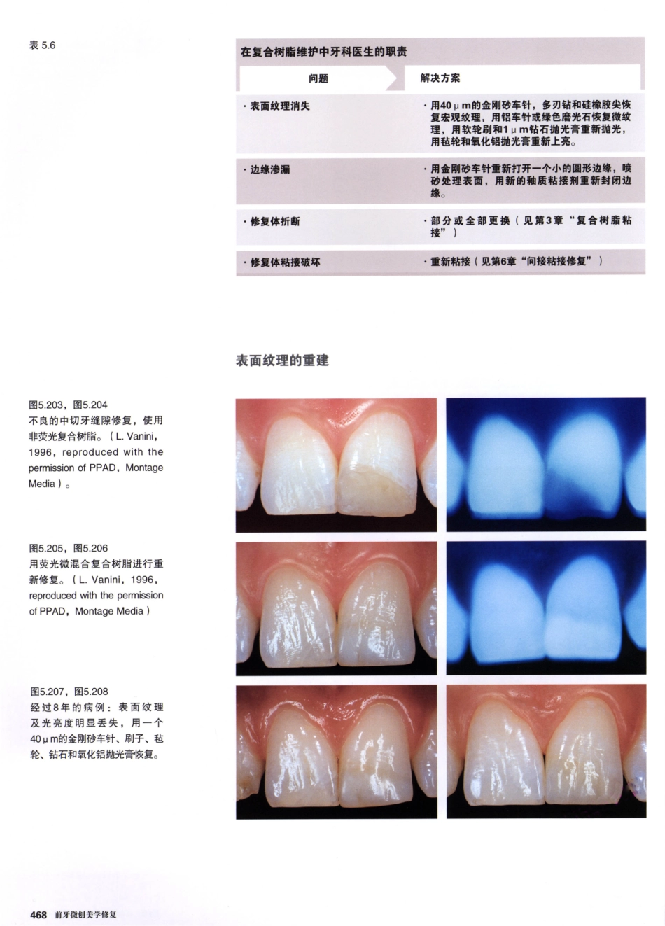 前牙微创美学修复（第2卷）_周锐2015（彩图）书签_61-75.pdf_第3页