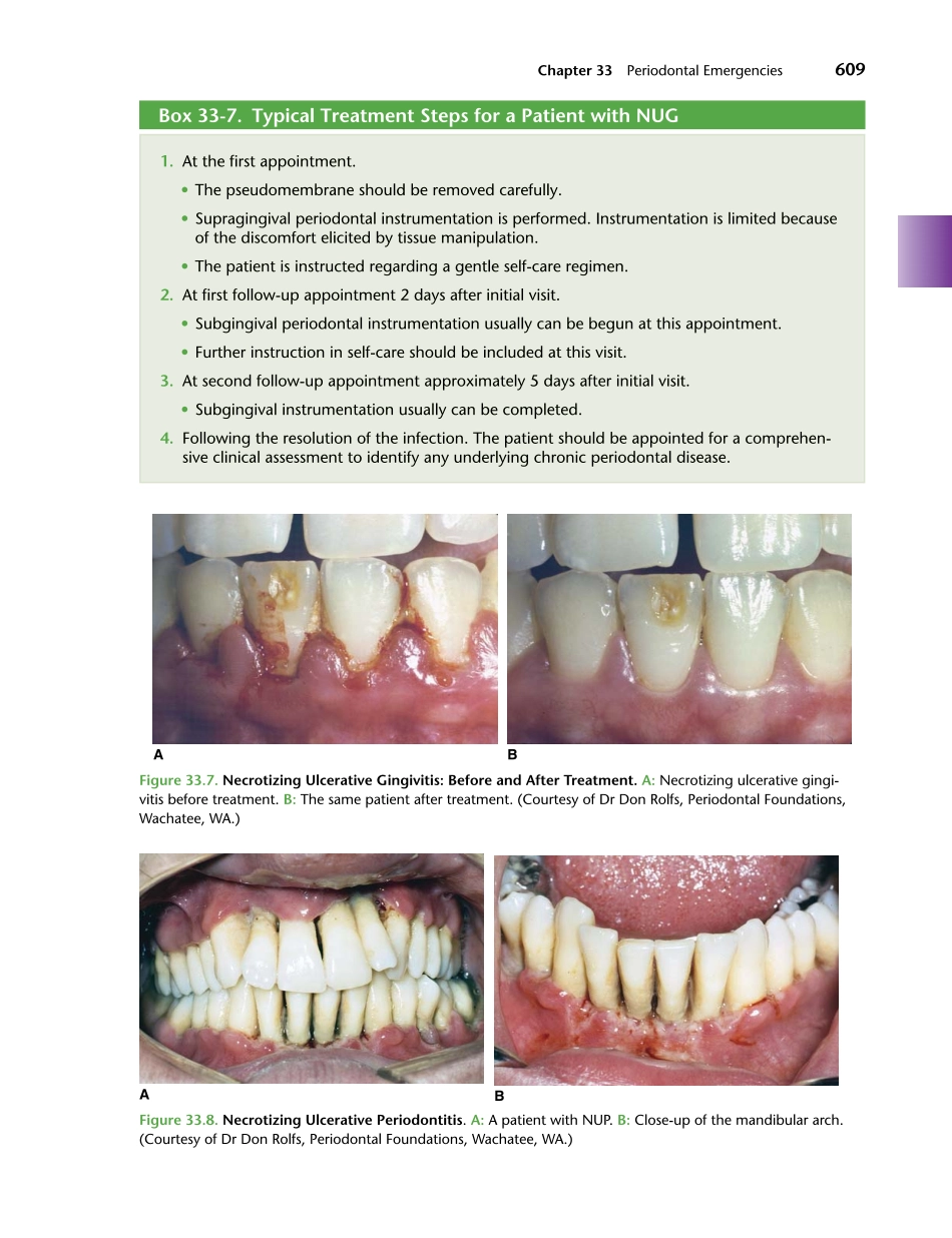 牙周2012Foundations of Periodontics for the Dental Hygienist _626-650.pdf_第2页