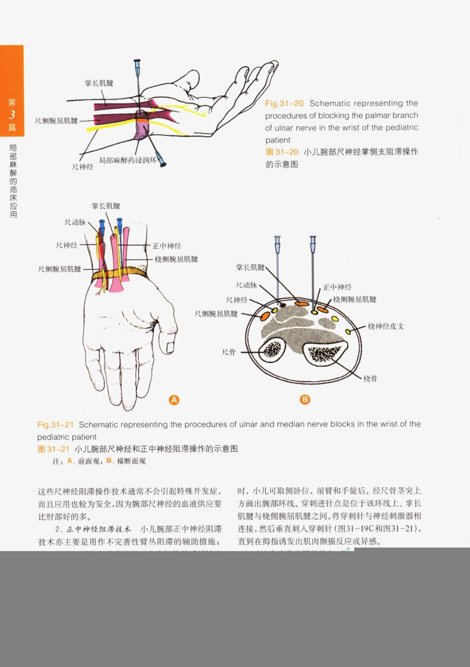 临床局部麻醉技术_501-525.pdf_第1页