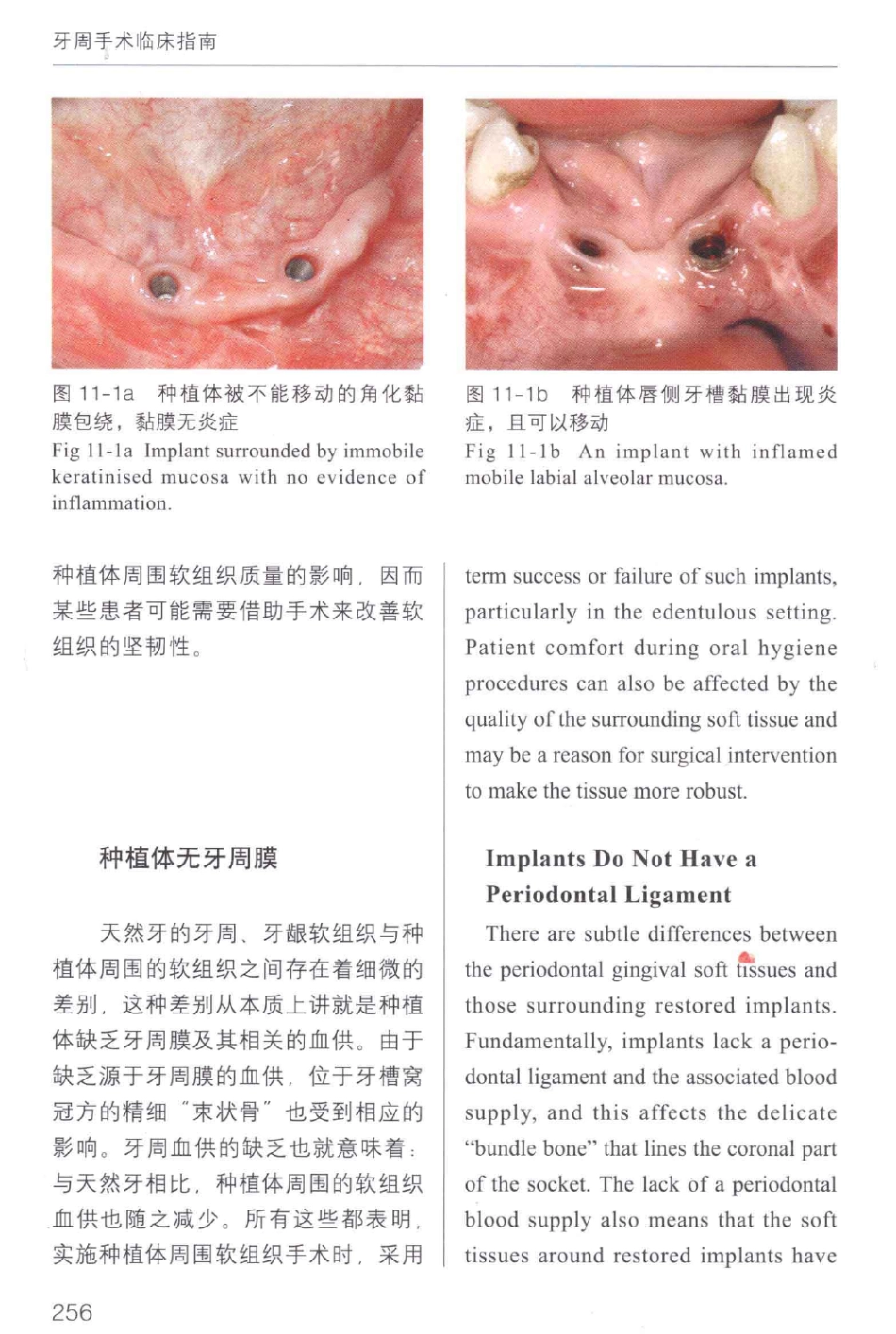 牙周手术临床指南 中英文对照_俞雪芬2013（彩图）_265-276.pdf_第2页