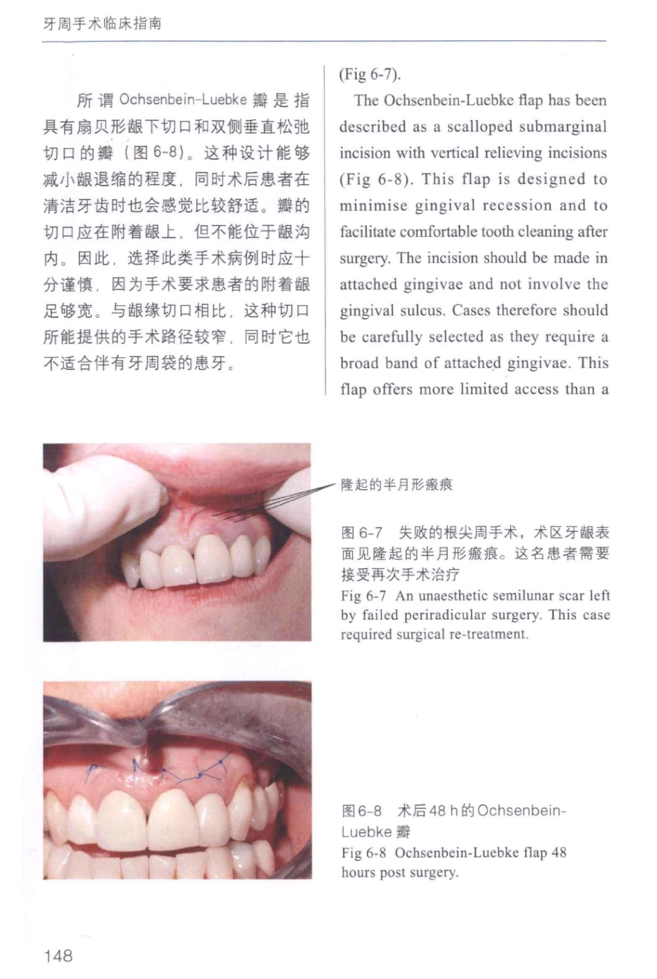 牙周手术临床指南 中英文对照_俞雪芬2013（彩图）_157-168.pdf_第2页