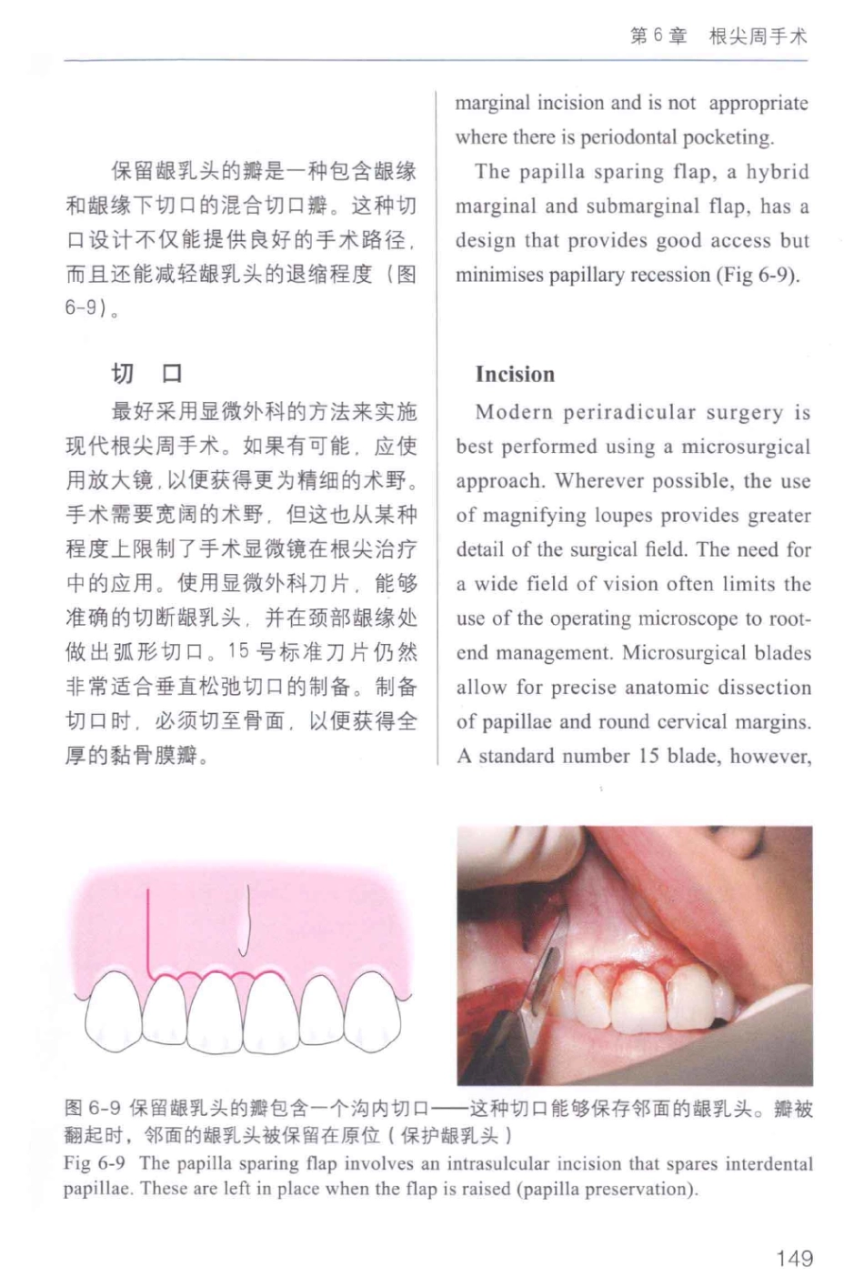 牙周手术临床指南 中英文对照_俞雪芬2013（彩图）_157-168.pdf_第3页