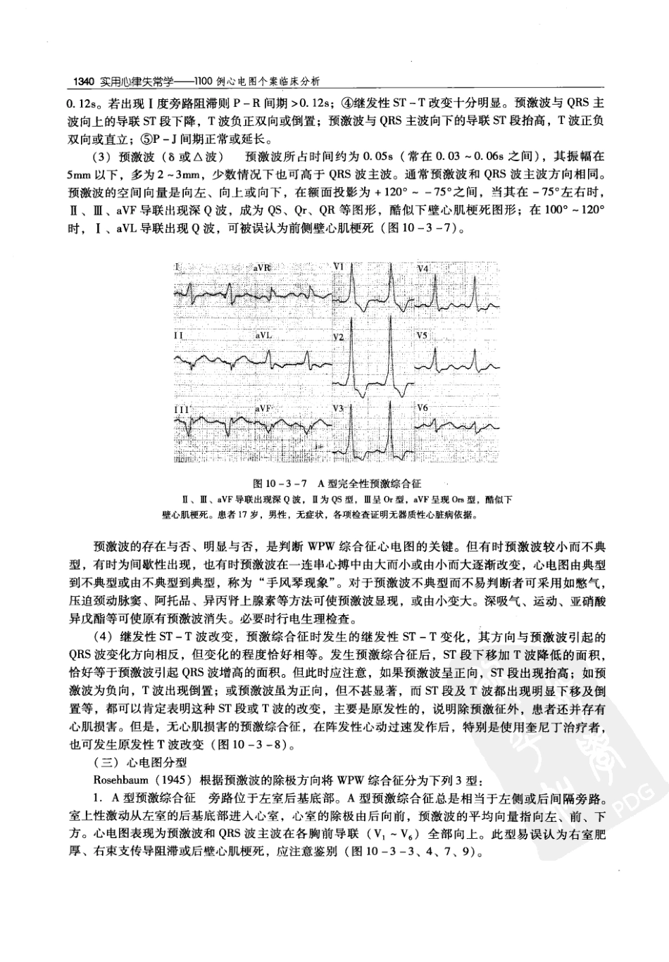实用心律失常学：1100例心电图个案临床分析  第2版_中国协和医科大学出版社_2008.10_夏宏器，邓开伯主编_1351-1400.pdf_第2页