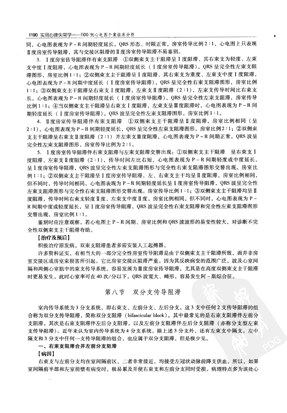 实用心律失常学：1100例心电图个案临床分析  第2版_中国协和医科大学出版社_2008.10_夏宏器，邓开伯主编_1201-1250.pdf_第2页