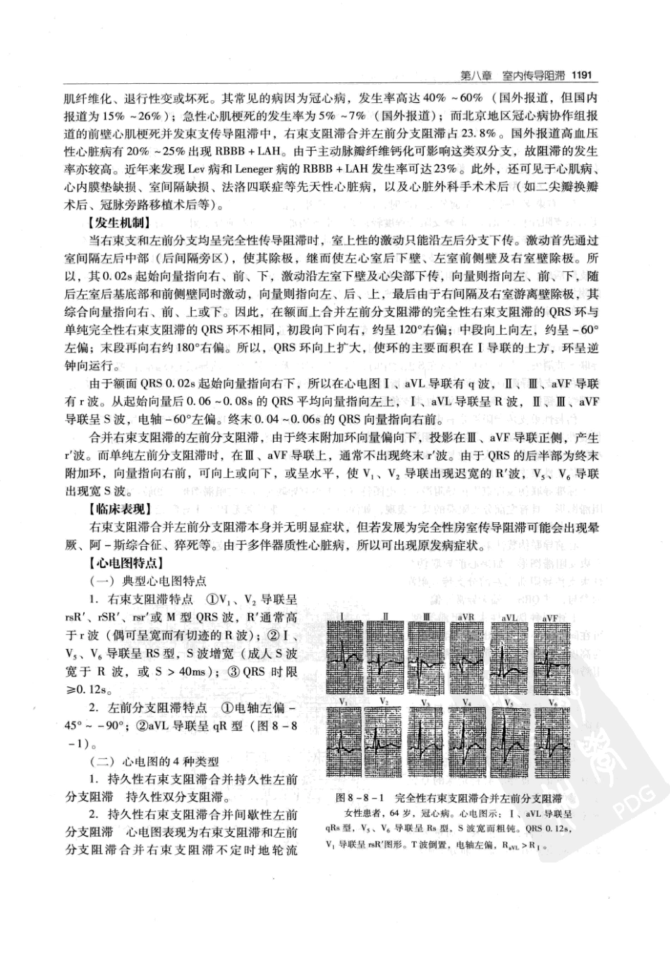 实用心律失常学：1100例心电图个案临床分析  第2版_中国协和医科大学出版社_2008.10_夏宏器，邓开伯主编_1201-1250.pdf_第3页