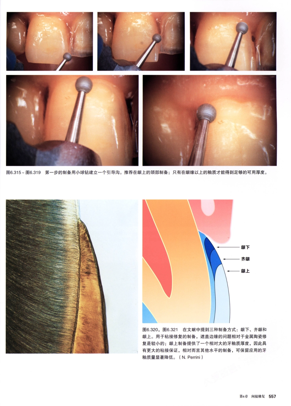 前牙微创美学修复（第2卷）_周锐2015（彩图）书签_151-165.pdf_第3页