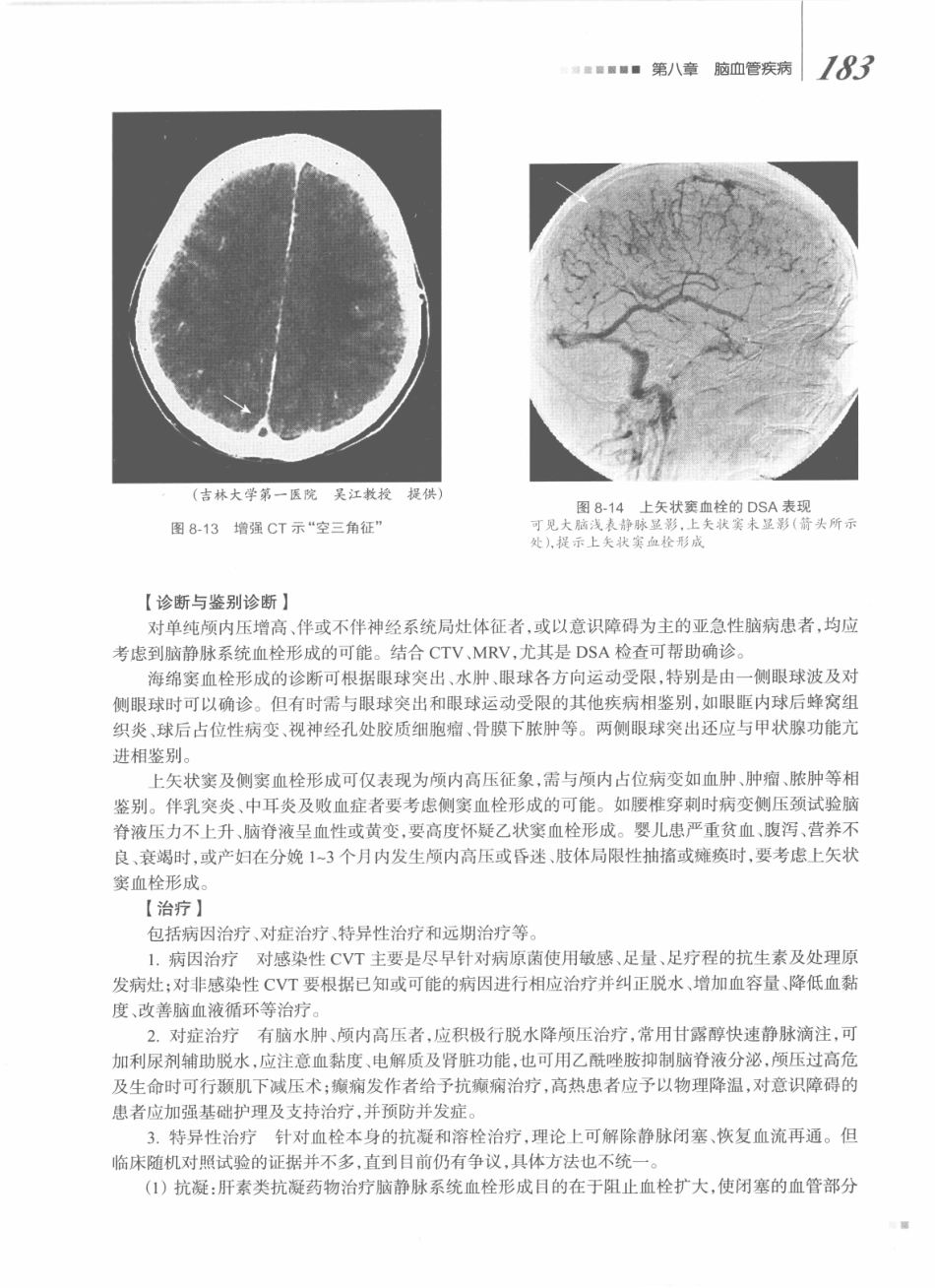 神经病学_八年制_201-220.pdf_第2页
