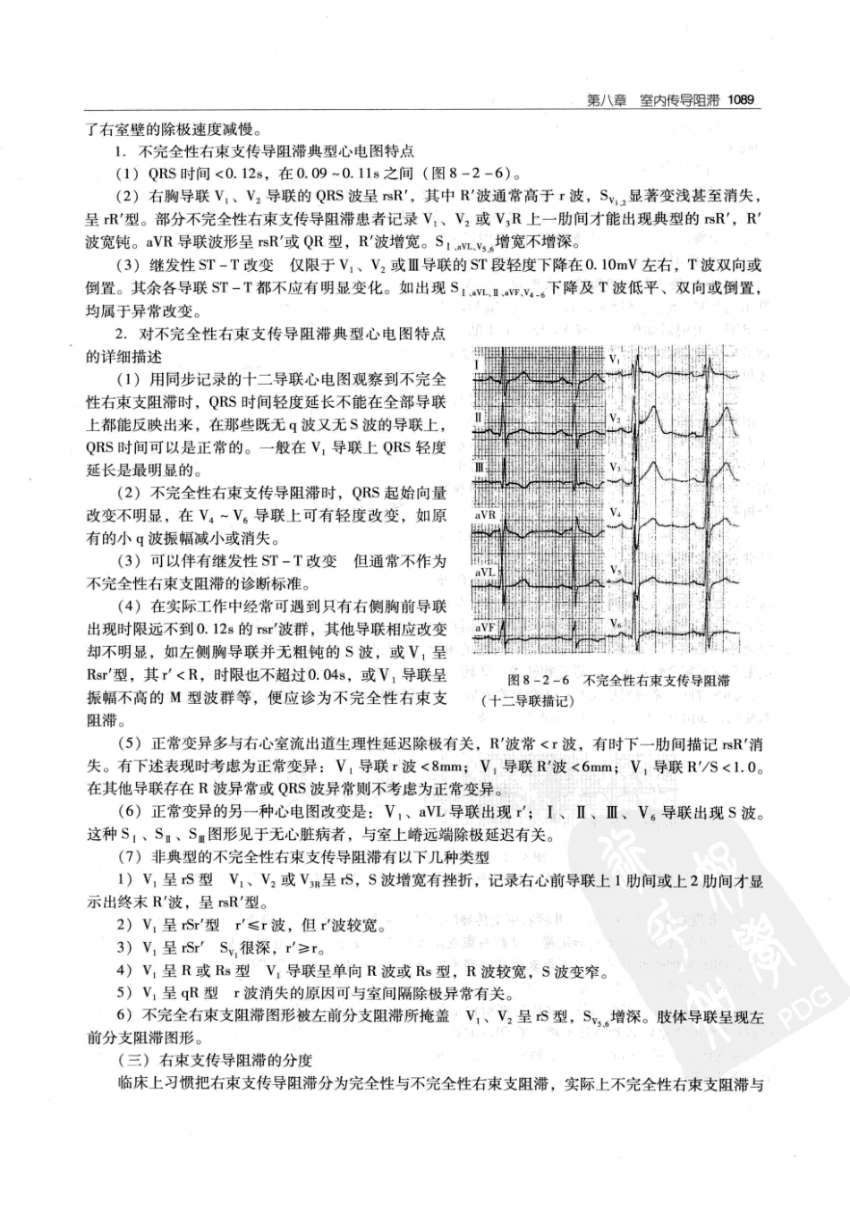 实用心律失常学：1100例心电图个案临床分析  第2版_中国协和医科大学出版社_2008.10_夏宏器，邓开伯主编_1101-1150.pdf_第1页