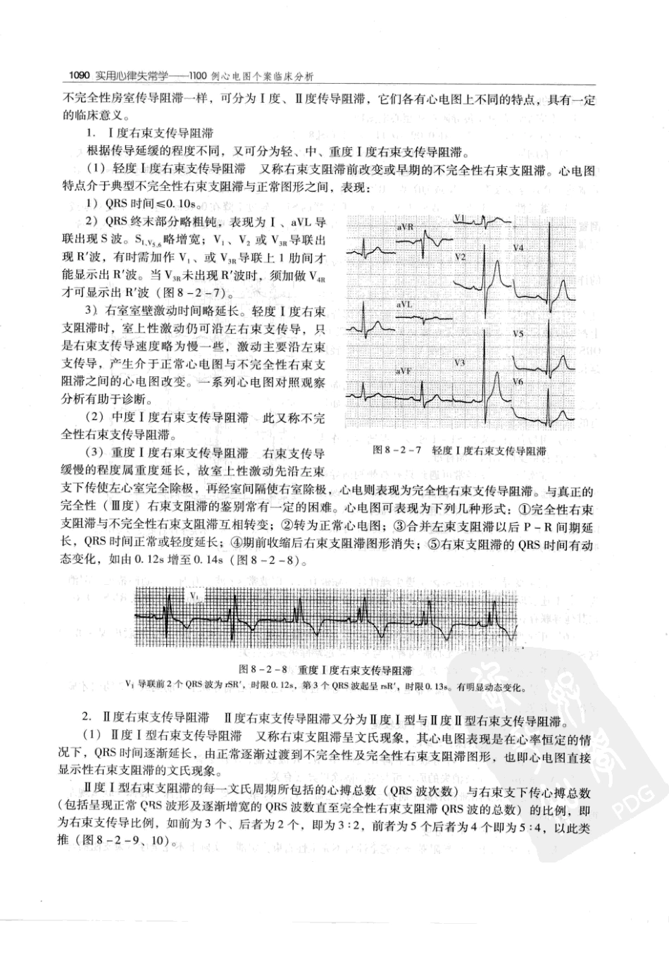 实用心律失常学：1100例心电图个案临床分析  第2版_中国协和医科大学出版社_2008.10_夏宏器，邓开伯主编_1101-1150.pdf_第2页