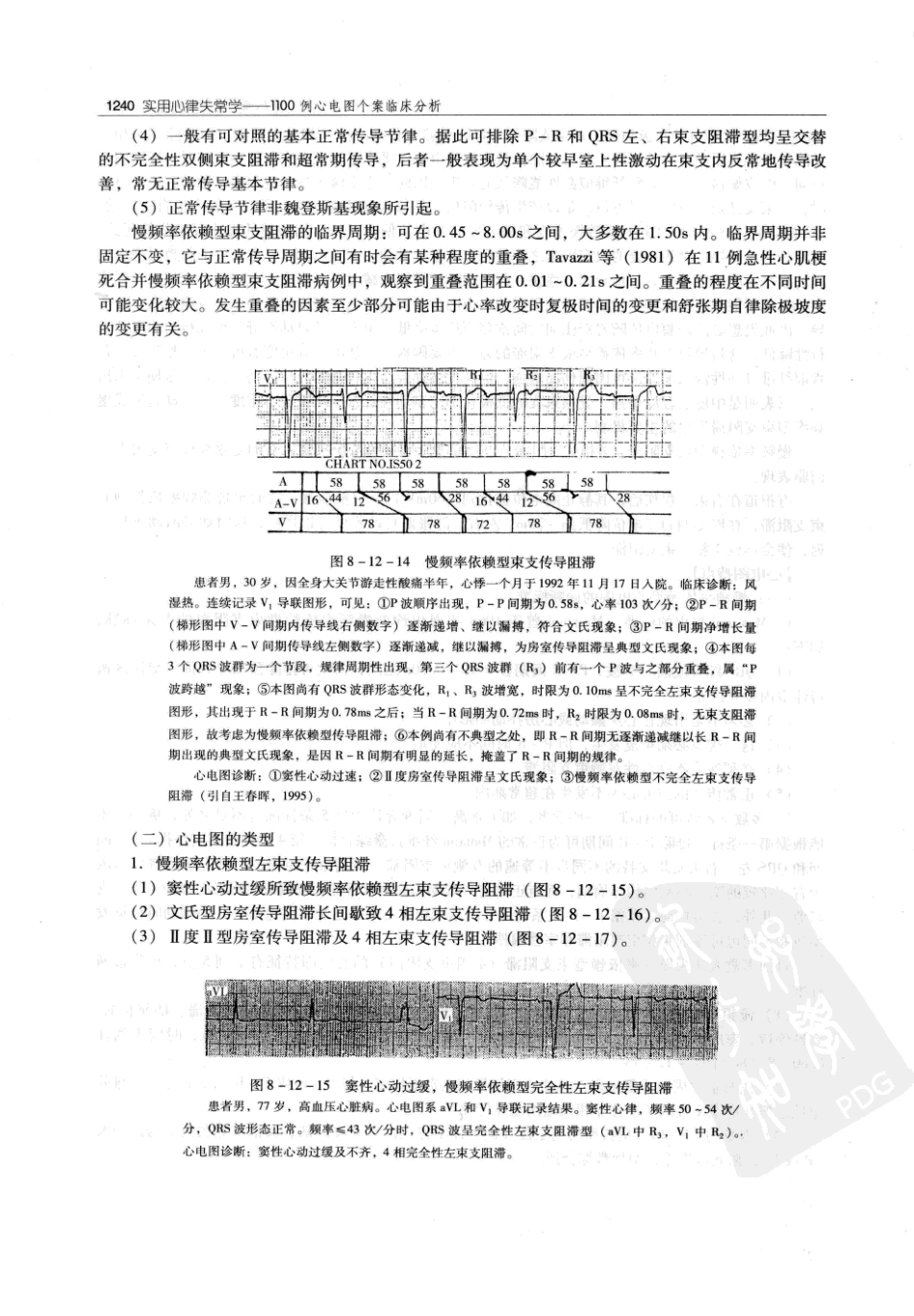 实用心律失常学：1100例心电图个案临床分析  第2版_中国协和医科大学出版社_2008.10_夏宏器，邓开伯主编_1251-1300.pdf_第2页