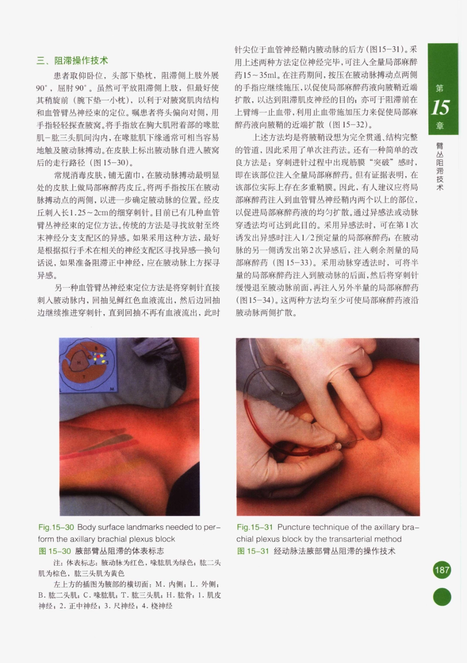 临床局部麻醉技术_201-225.pdf_第2页