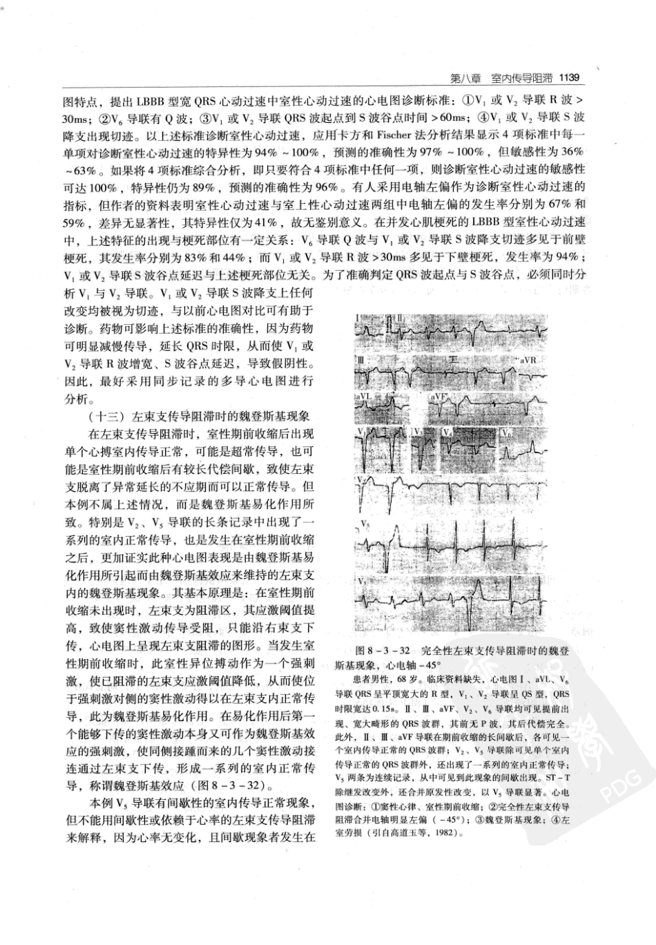 实用心律失常学：1100例心电图个案临床分析  第2版_中国协和医科大学出版社_2008.10_夏宏器，邓开伯主编_1151-1200.pdf_第1页