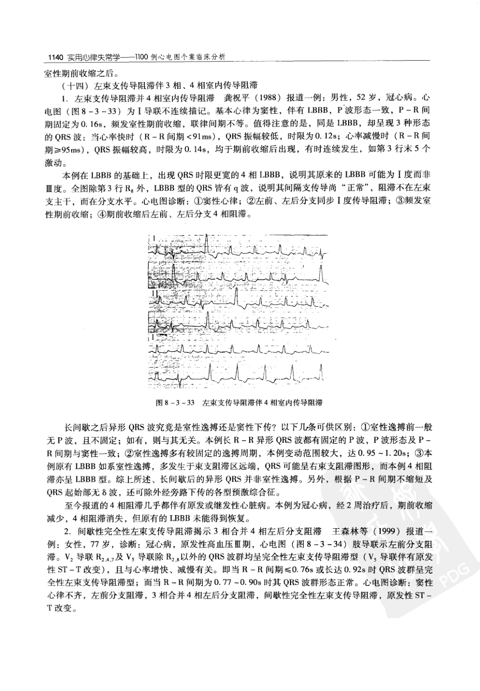 实用心律失常学：1100例心电图个案临床分析  第2版_中国协和医科大学出版社_2008.10_夏宏器，邓开伯主编_1151-1200.pdf_第2页