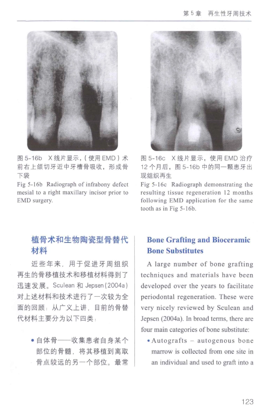 牙周手术临床指南 中英文对照_俞雪芬2013（彩图）_133-144.pdf_第1页