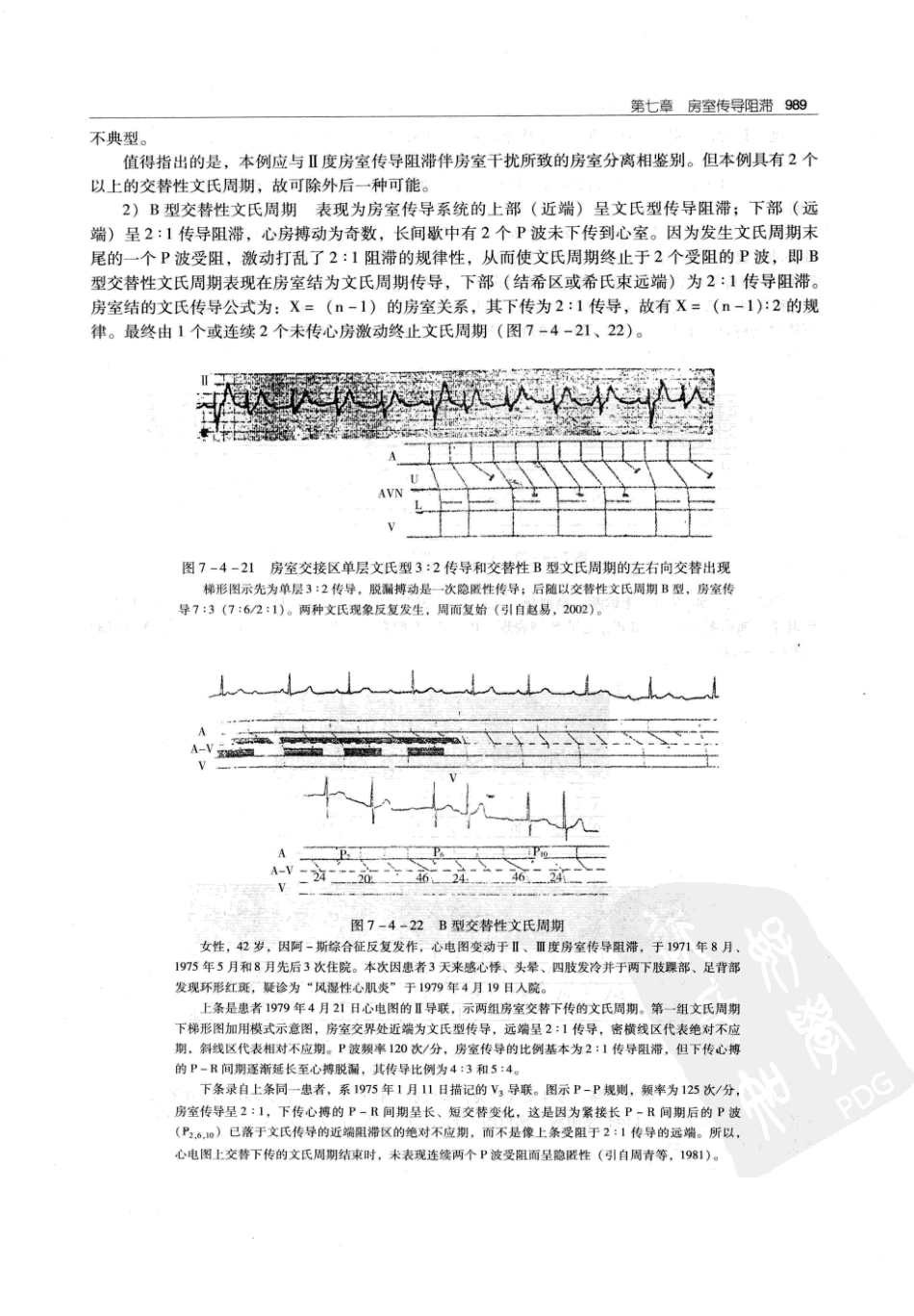 实用心律失常学：1100例心电图个案临床分析  第2版_中国协和医科大学出版社_2008.10_夏宏器，邓开伯主编_1001-1050.pdf_第1页