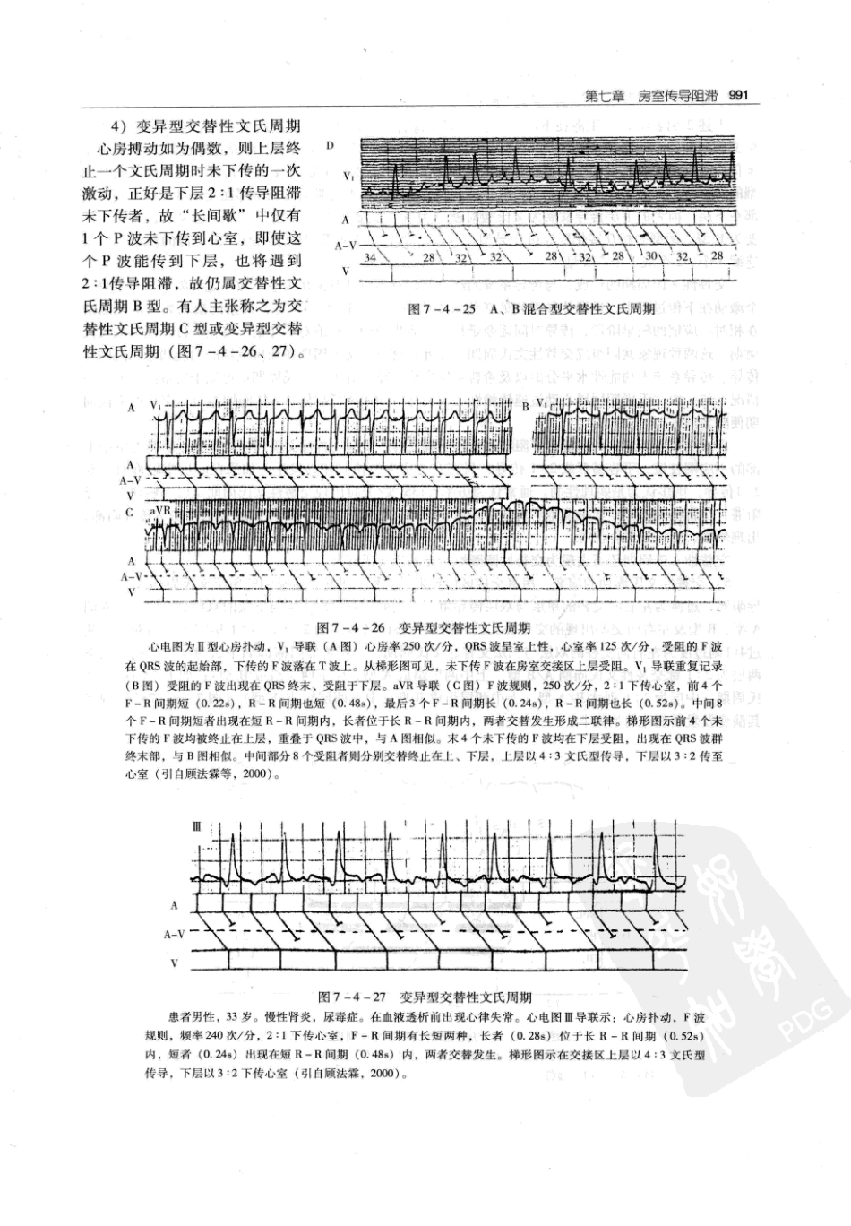 实用心律失常学：1100例心电图个案临床分析  第2版_中国协和医科大学出版社_2008.10_夏宏器，邓开伯主编_1001-1050.pdf_第3页