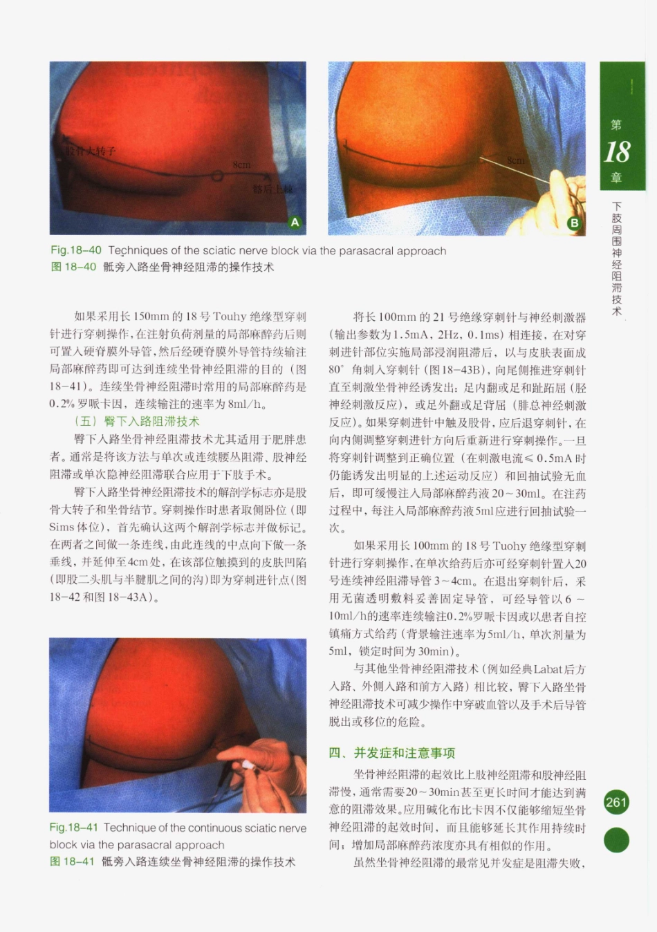 临床局部麻醉技术_276-300.pdf_第1页