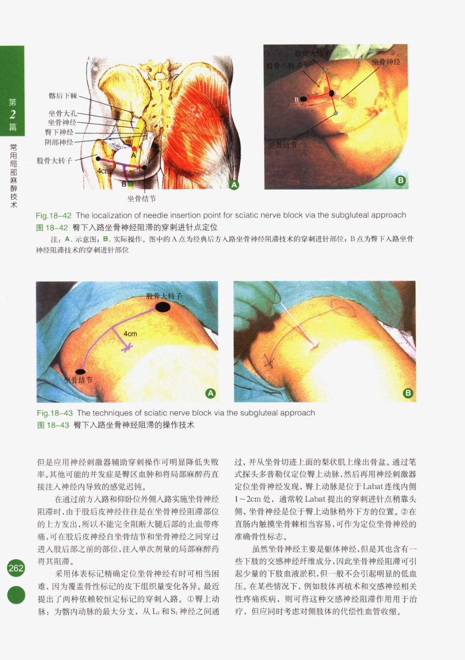 临床局部麻醉技术_276-300.pdf_第2页