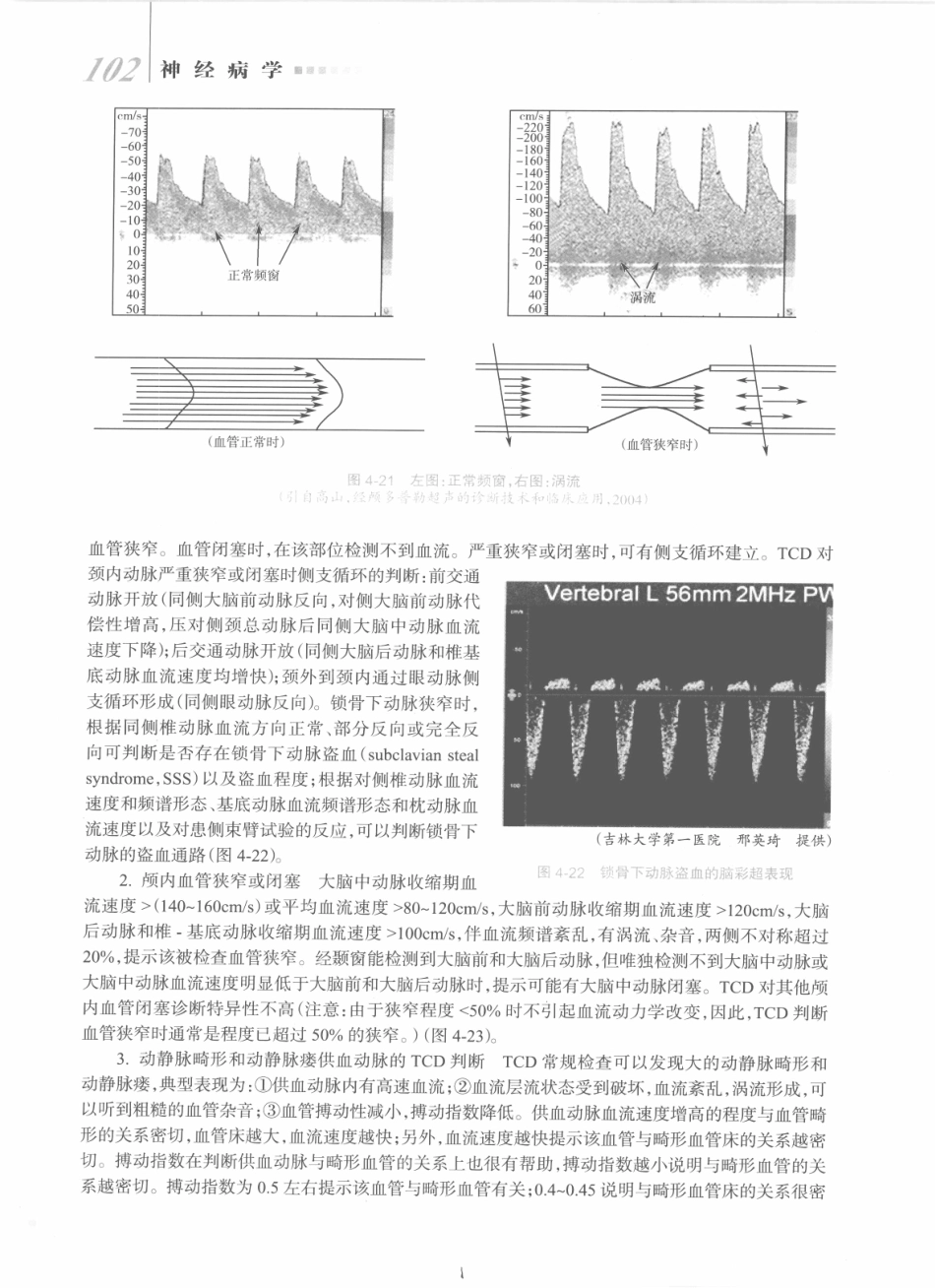 神经病学_八年制_121-140.pdf_第1页