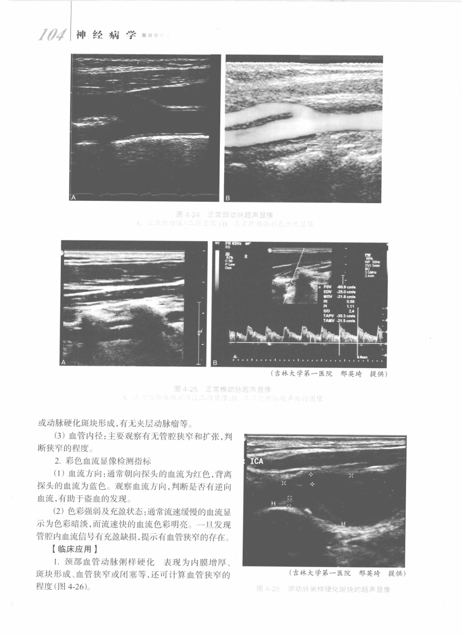 神经病学_八年制_121-140.pdf_第3页