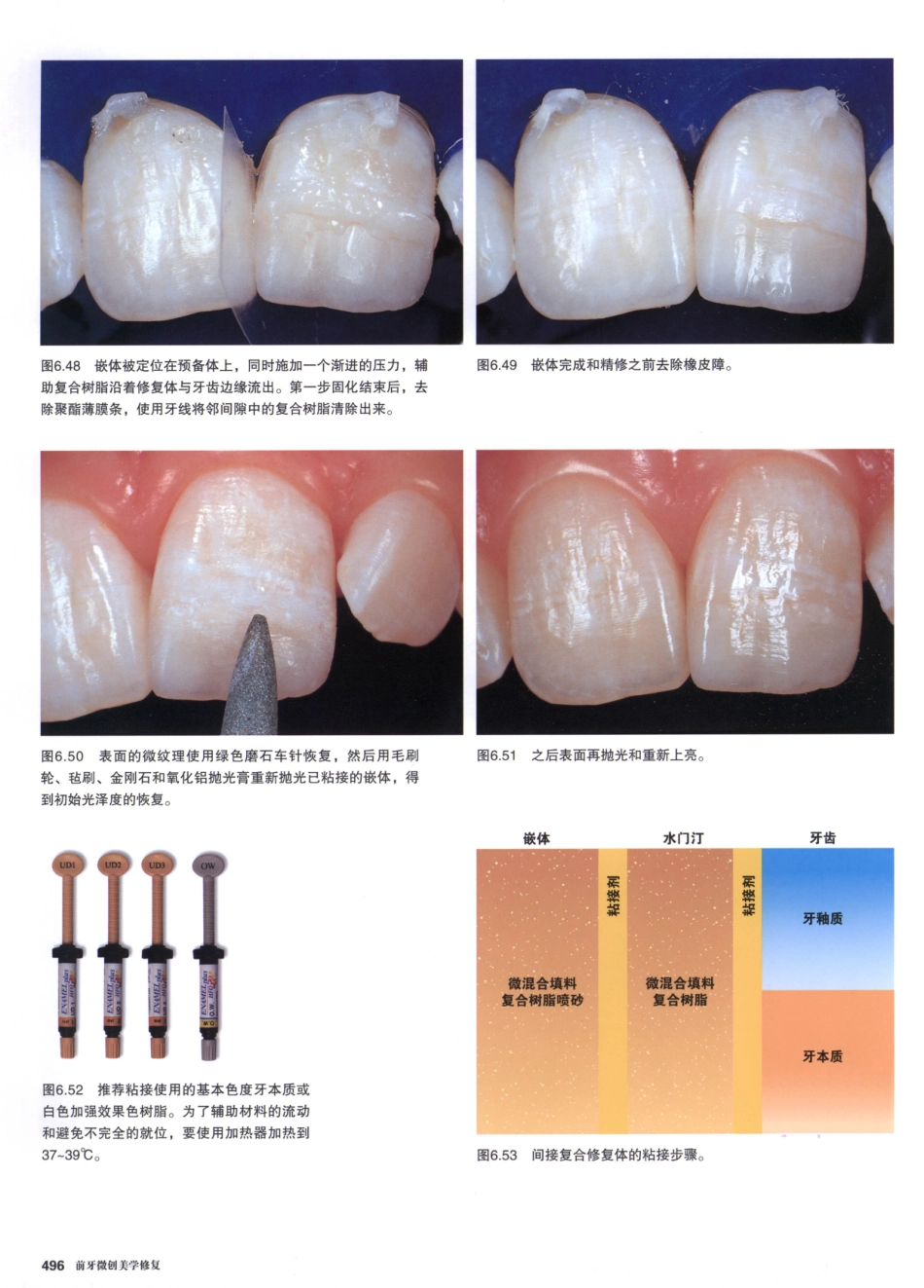 前牙微创美学修复（第2卷）_周锐2015（彩图）书签_91-105.pdf_第2页