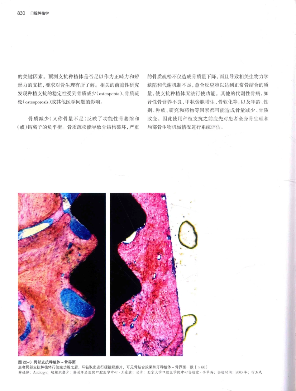 口腔种植学（第2版）_宿玉成主编_2014年（彩图）_871-900.pdf_第3页