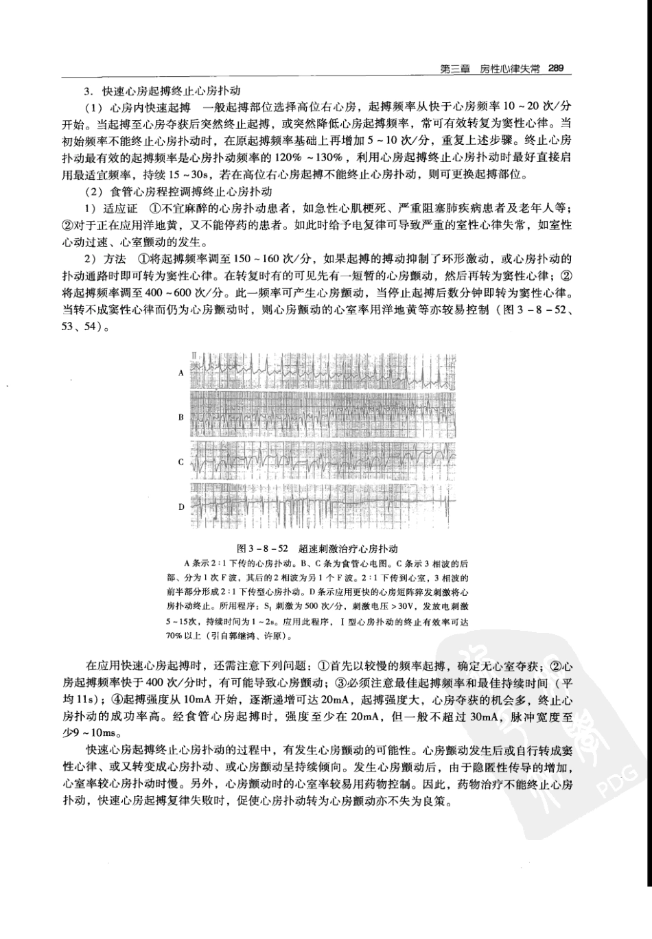 实用心律失常学：1100例心电图个案临床分析  第2版_中国协和医科大学出版社_2008.10_夏宏器，邓开伯主编_301-350.pdf_第1页