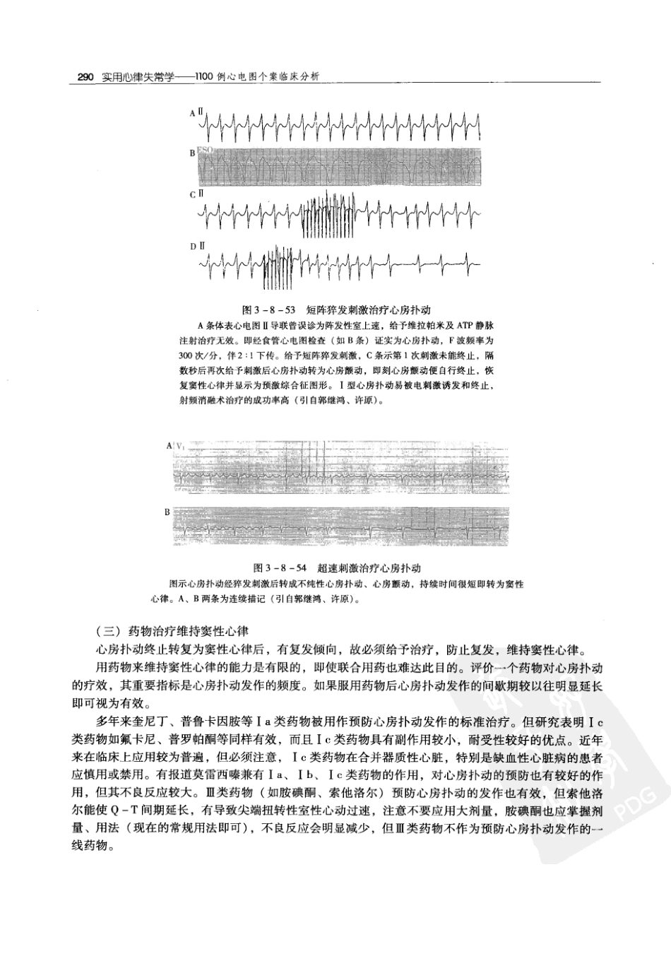 实用心律失常学：1100例心电图个案临床分析  第2版_中国协和医科大学出版社_2008.10_夏宏器，邓开伯主编_301-350.pdf_第2页