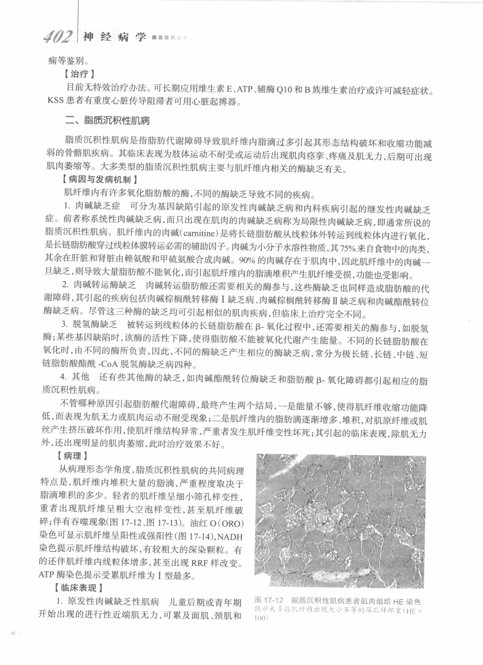 神经病学_八年制_421-440.pdf_第1页