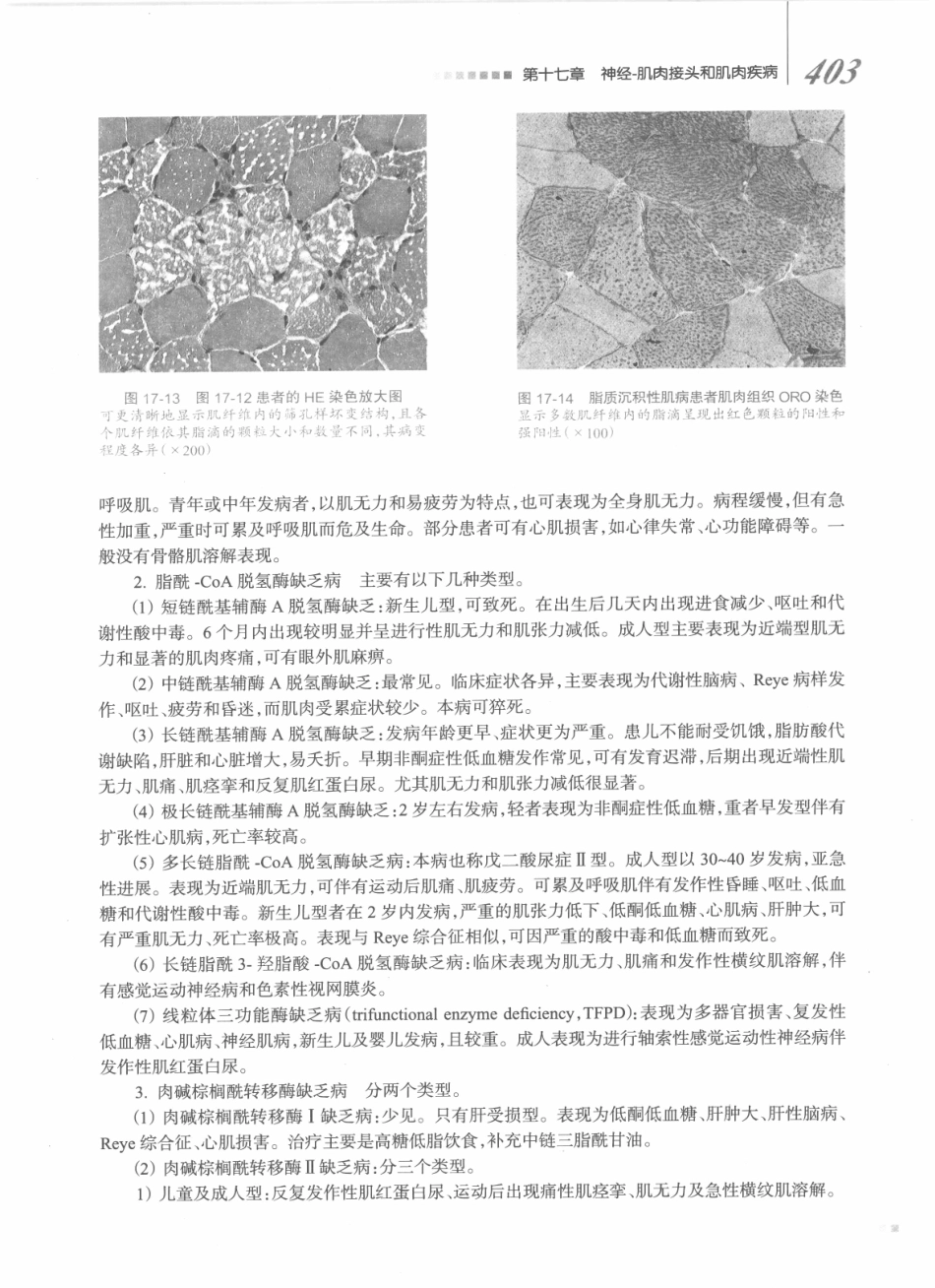 神经病学_八年制_421-440.pdf_第2页