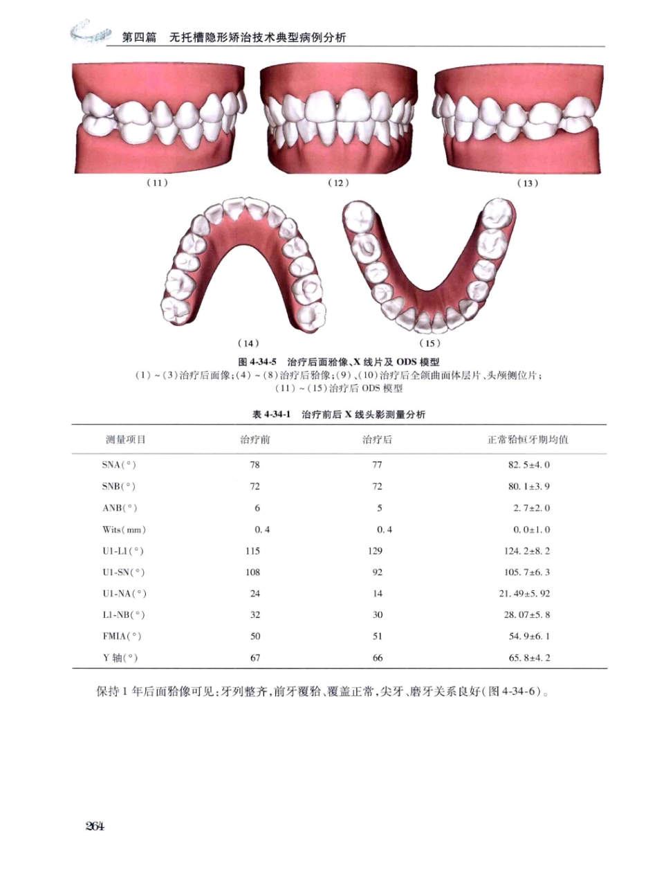 口腔正畸现代无托槽隐形矫治技术 田杰著 2014_277-288.pdf_第2页