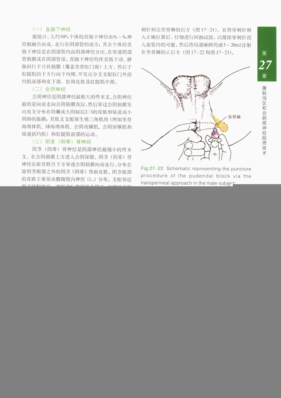 临床局部麻醉技术_426-450.pdf_第3页