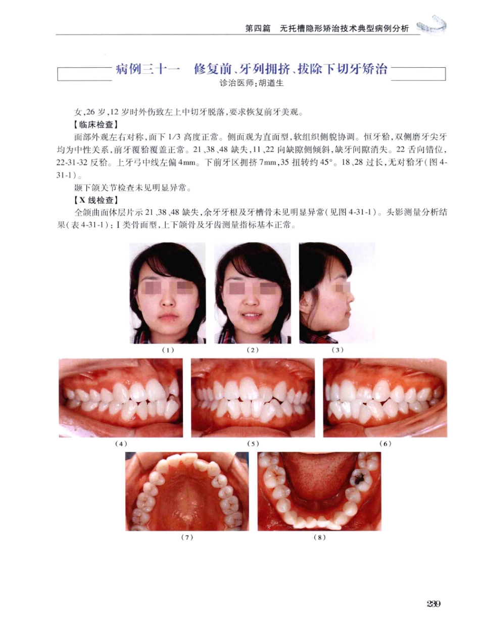 口腔正畸现代无托槽隐形矫治技术 田杰著 2014_253-264.pdf_第1页
