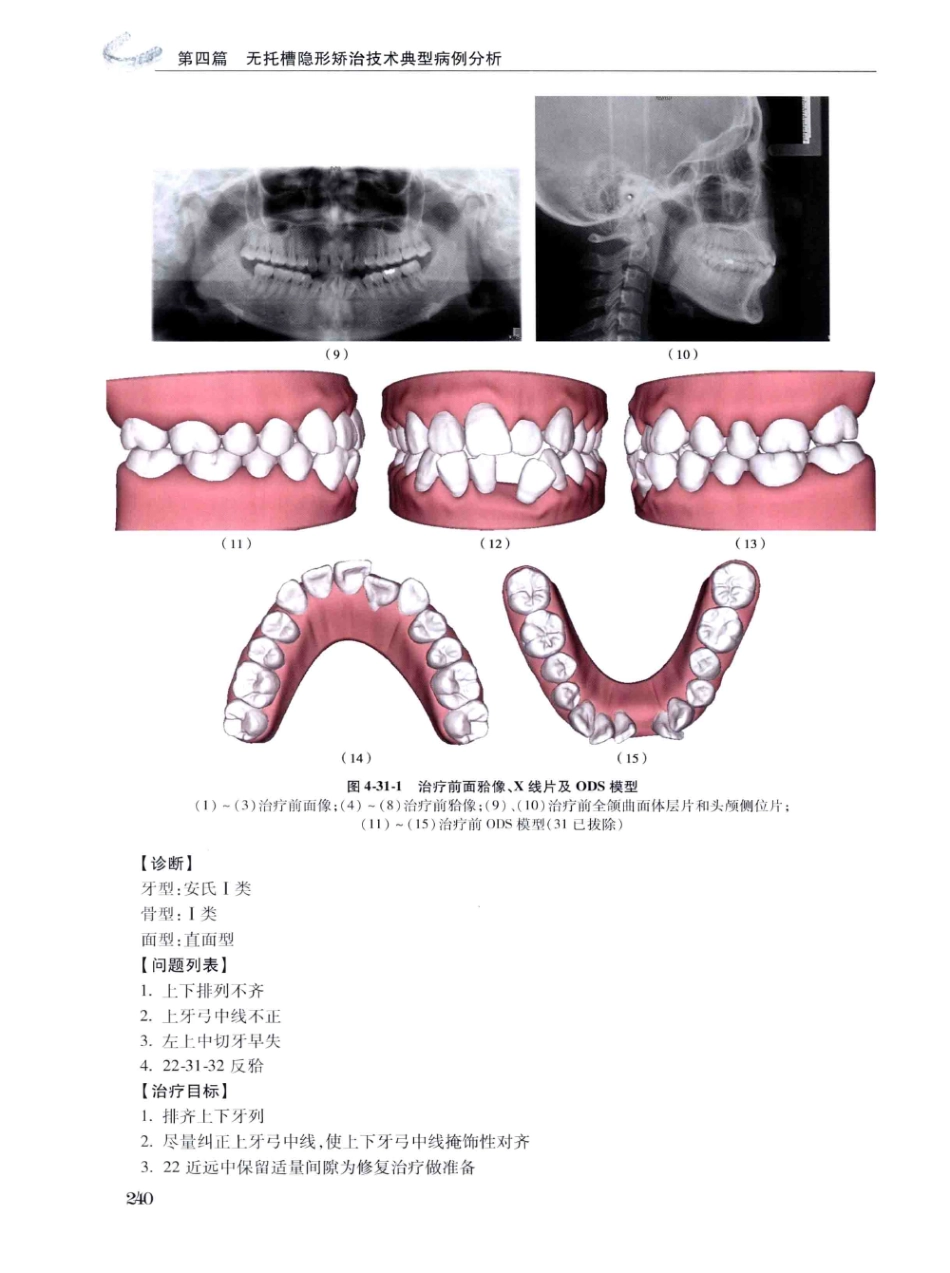 口腔正畸现代无托槽隐形矫治技术 田杰著 2014_253-264.pdf_第2页