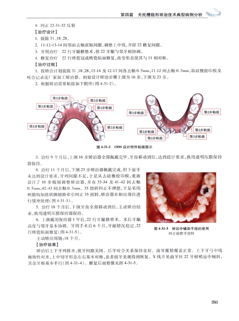 口腔正畸现代无托槽隐形矫治技术 田杰著 2014_253-264.pdf_第3页