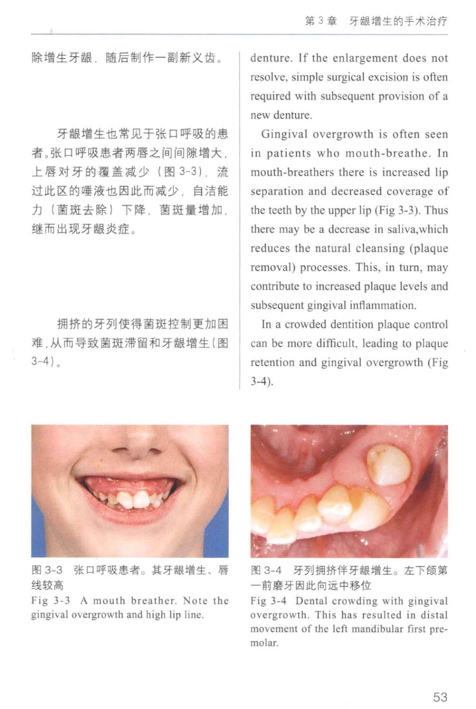牙周手术临床指南 中英文对照_俞雪芬2013（彩图）_61-72.pdf_第3页