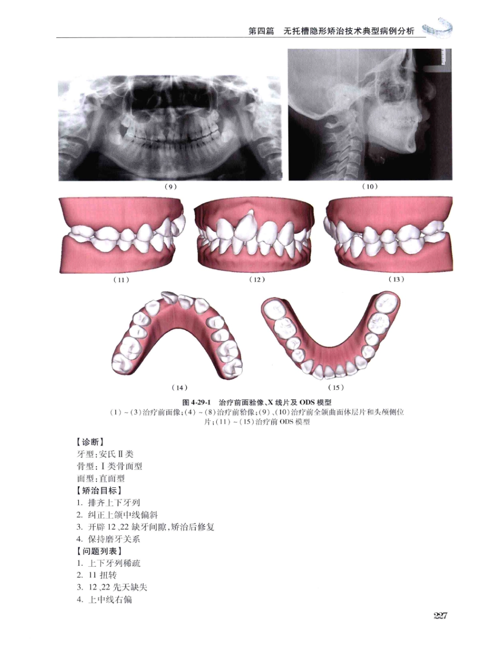 口腔正畸现代无托槽隐形矫治技术 田杰著 2014_241-252.pdf_第1页
