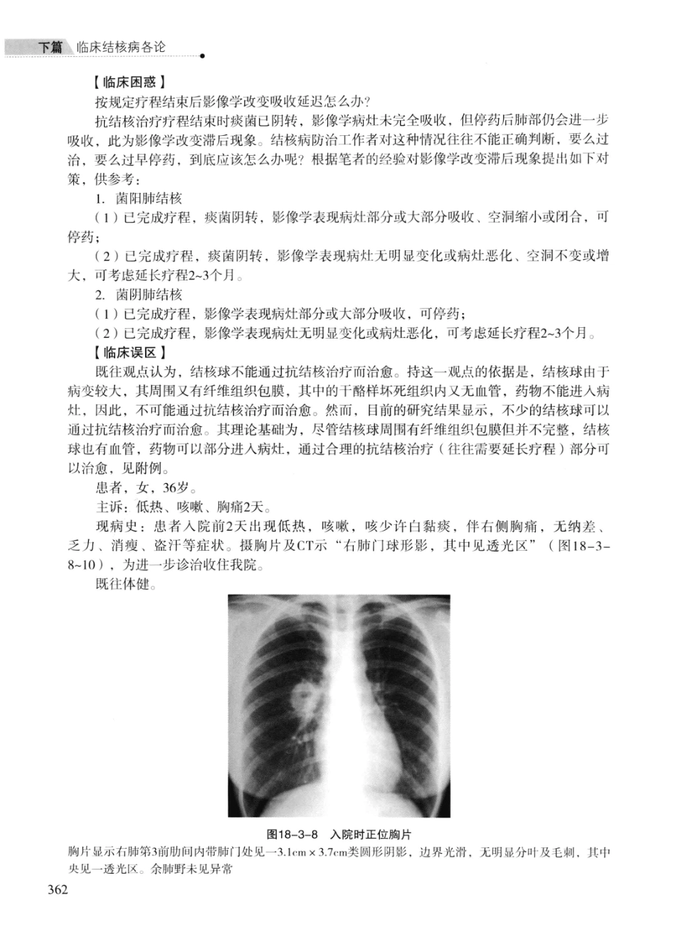 临床结核病学 （临床、影像、病例、误区及_13008036_376-400.pdf_第1页