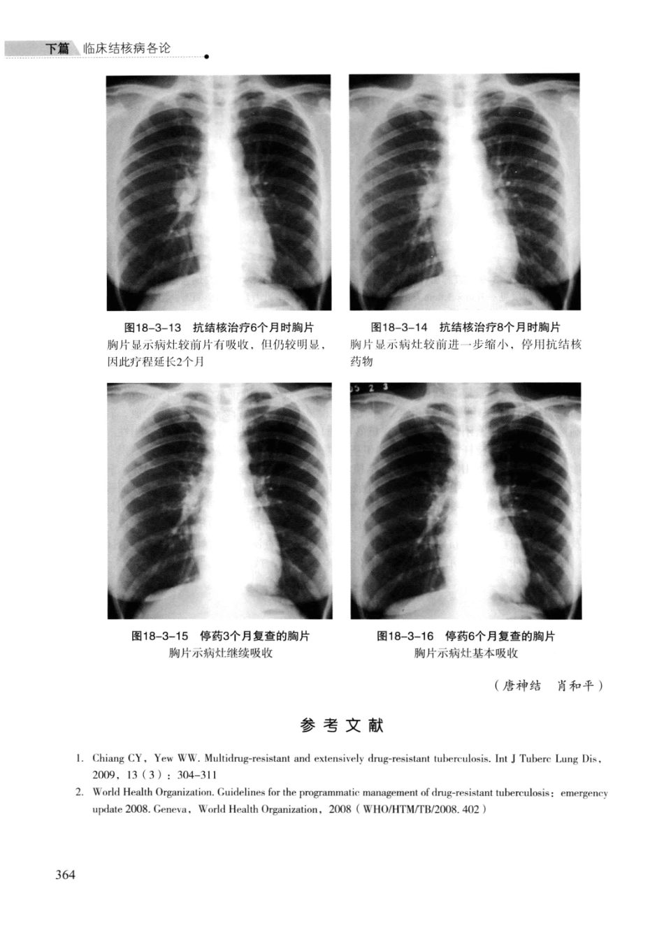 临床结核病学 （临床、影像、病例、误区及_13008036_376-400.pdf_第3页