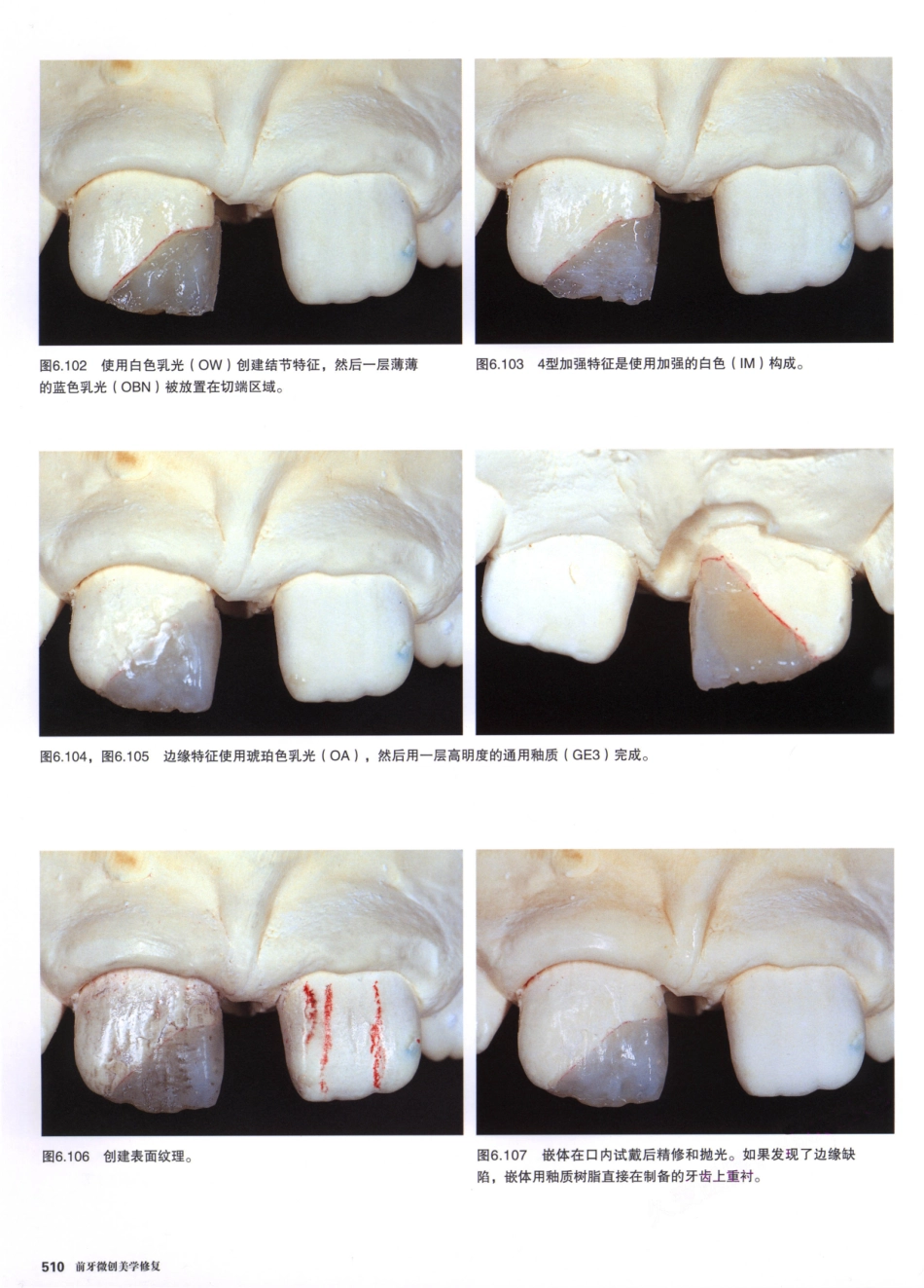 前牙微创美学修复（第2卷）_周锐2015（彩图）书签_106-120.pdf_第1页