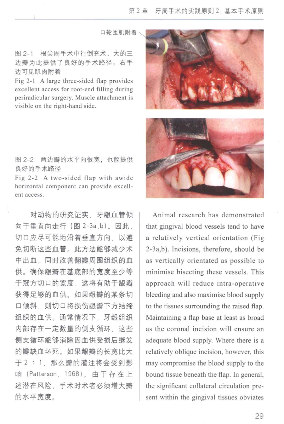牙周手术临床指南 中英文对照_俞雪芬2013（彩图）_37-48.pdf_第3页