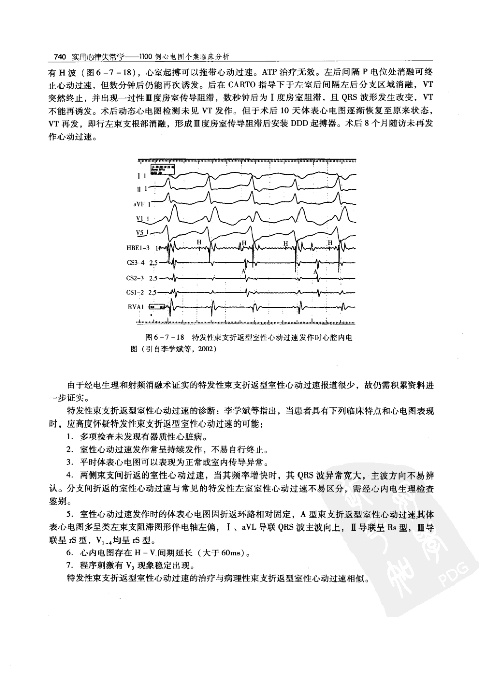 实用心律失常学：1100例心电图个案临床分析  第2版_中国协和医科大学出版社_2008.10_夏宏器，邓开伯主编_751-800.pdf_第2页