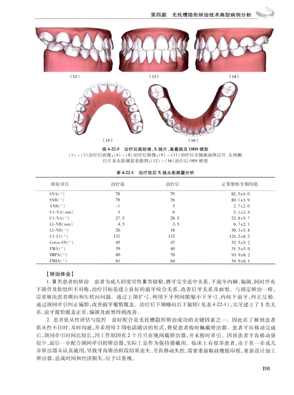 口腔正畸现代无托槽隐形矫治技术 田杰著 2014_205-216.pdf_第1页