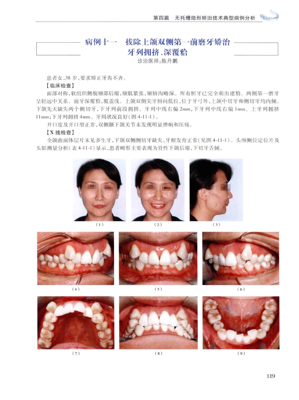 口腔正畸现代无托槽隐形矫治技术 田杰著 2014_133-144.pdf_第1页