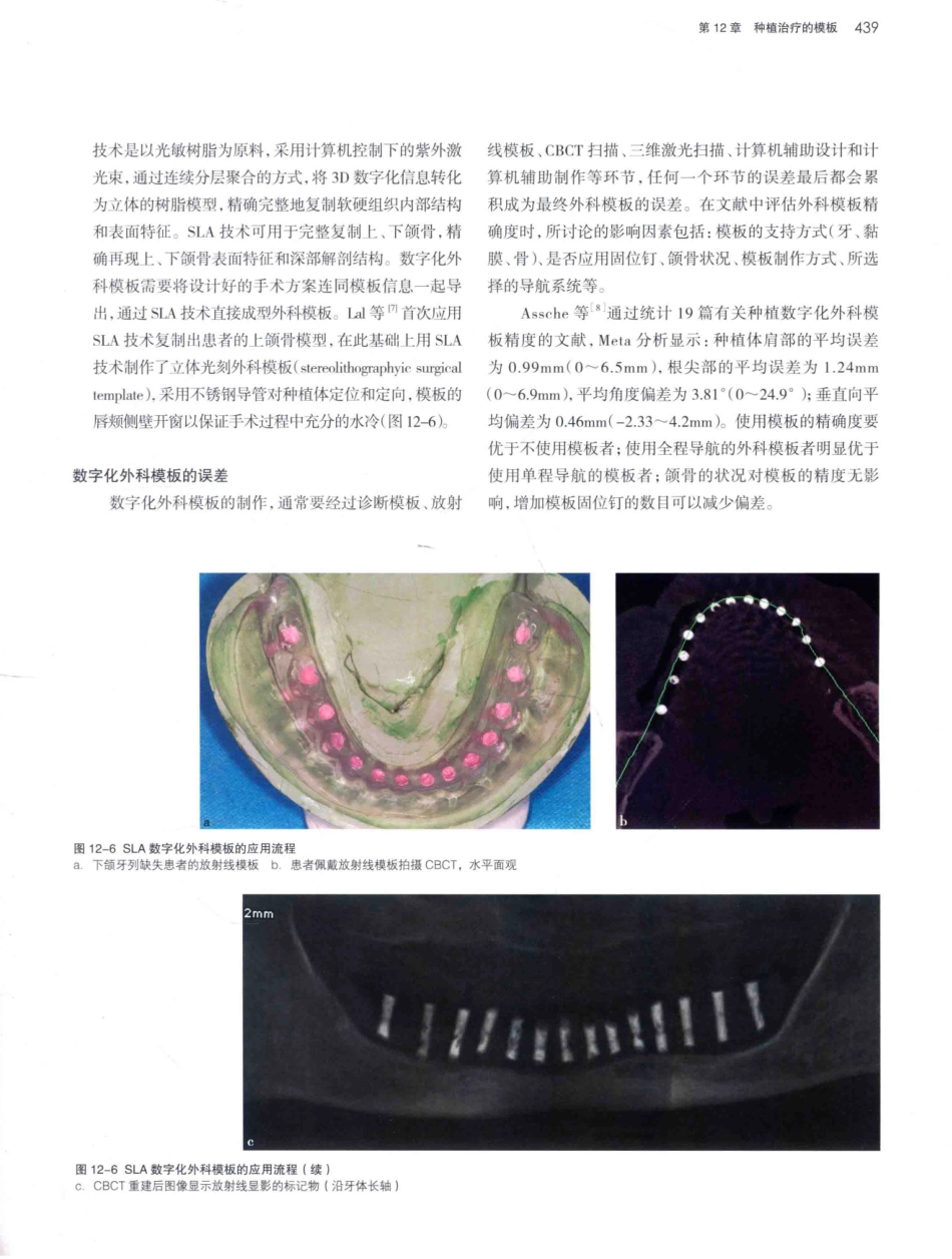 口腔种植学（第2版）_宿玉成主编_2014年（彩图）_481-510.pdf_第2页