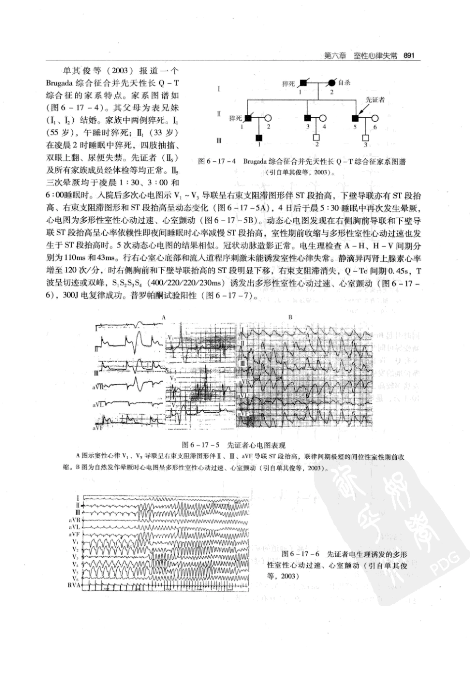 实用心律失常学：1100例心电图个案临床分析  第2版_中国协和医科大学出版社_2008.10_夏宏器，邓开伯主编_901-950.pdf_第3页