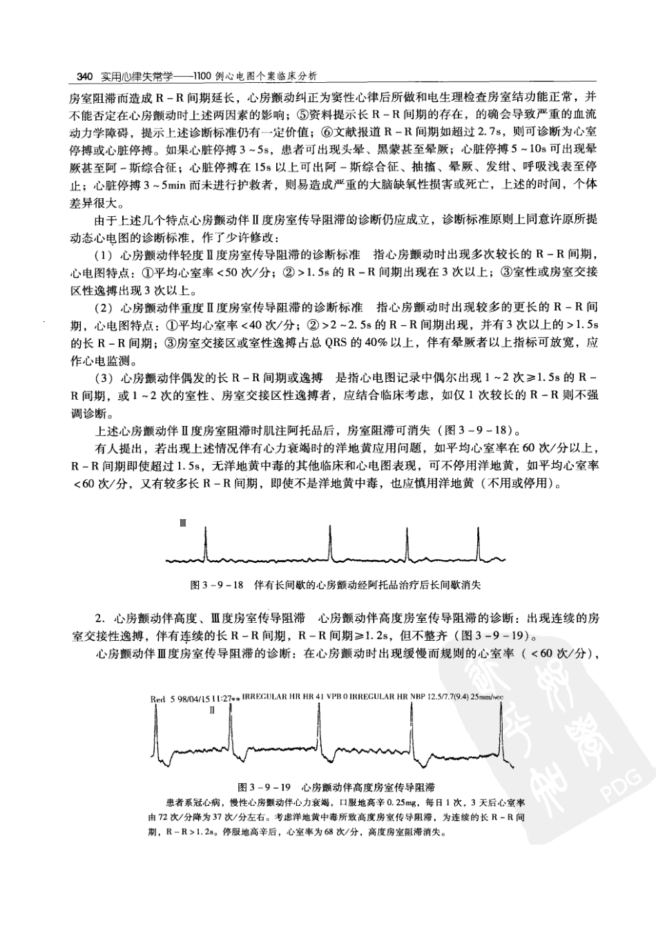 实用心律失常学：1100例心电图个案临床分析  第2版_中国协和医科大学出版社_2008.10_夏宏器，邓开伯主编_351-400.pdf_第2页