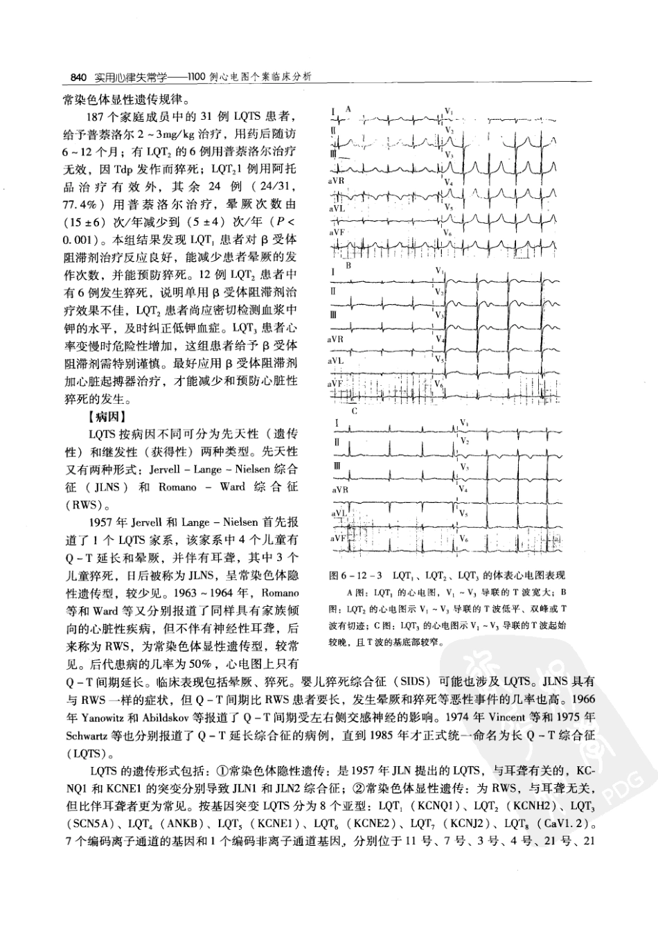 实用心律失常学：1100例心电图个案临床分析  第2版_中国协和医科大学出版社_2008.10_夏宏器，邓开伯主编_851-900.pdf_第2页